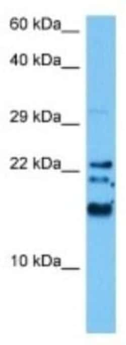 IFITM3/Fragilis Rabbit anti-Human, Polyclonal, Novus Biologicals 100 &mu;g;